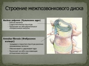 Грыжа-межпозвоночного-диска