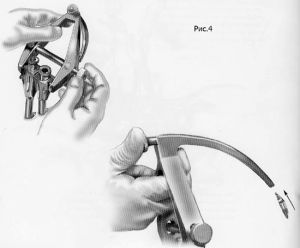 Рис.7-4. Схема миниинвазивной технологии транспедикулярной фиксации позвоночника. На держатели винтов надевается устройство для проведения стержня по заданной траектории.