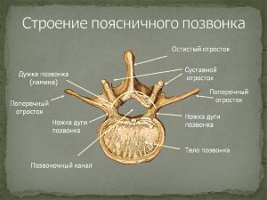 Рис. 4 Строение поясничного позвонка (аксиальная проекция).